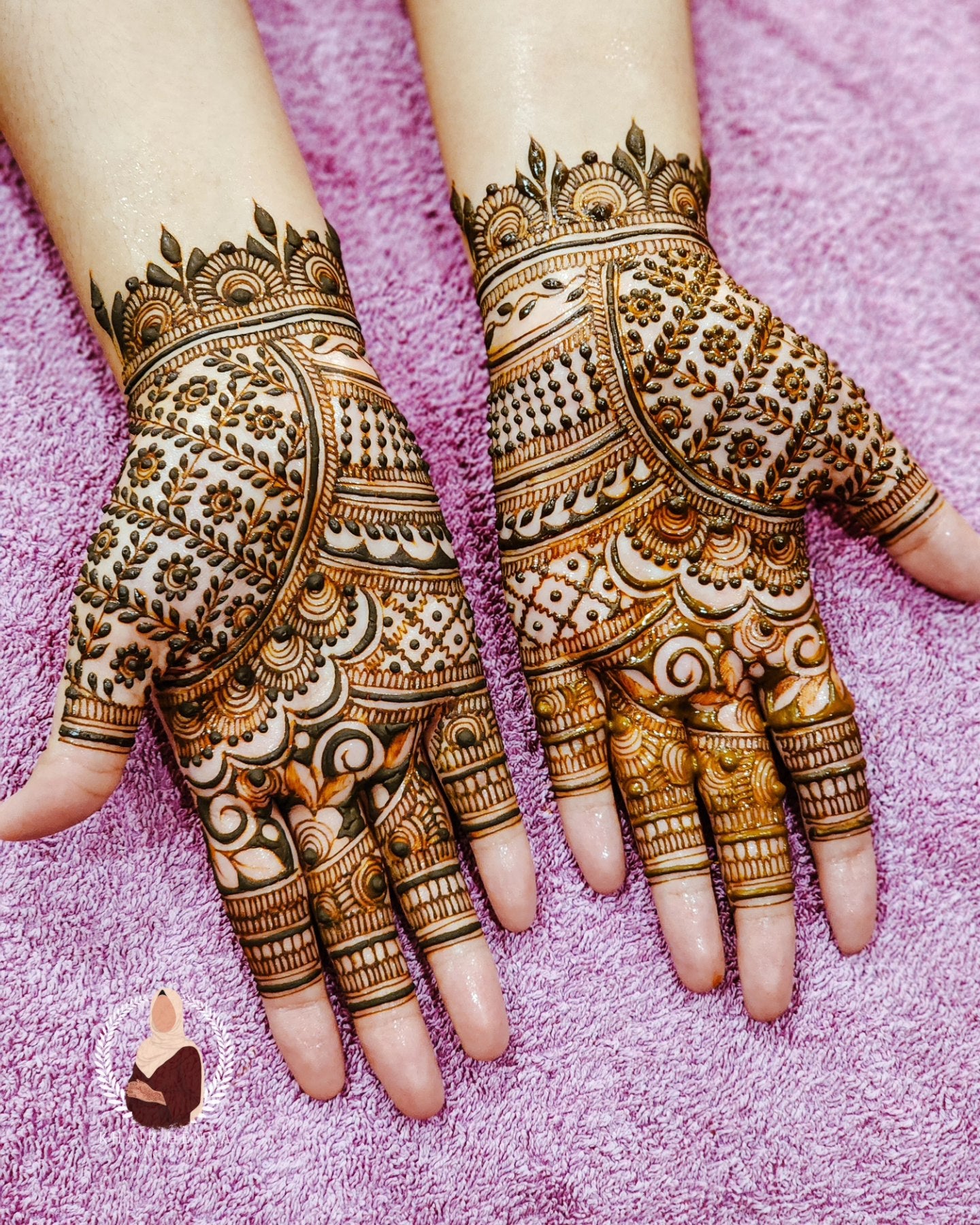 Above Wrist $290